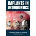 Implants in Orthodontics - Paperback