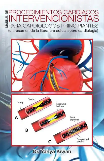 Manual de Procedimientos Cardiacos Intervencionistas Para Cardiólogos Principiantes: (un Resumen de la Literatura Actual Sobre Cardiología) - Paperback