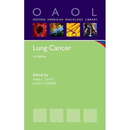 Lung Cancer - Paperback