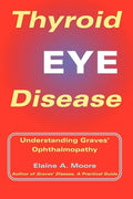 Thyroid Eye Disease: Understanding Graves' Ophthalmopathy - Paperback