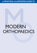 A Practical Illustrated Guide to Modern Orthopaedics - Paperback