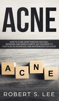 Acne: How to Cure Acne through Natural Remedies and Simple Habits. Say Goodbye to Pustules, Blackheads and Whiteheads for Good! - Hardcover