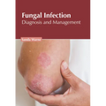 Fungal Infection: Diagnosis and Management - Hardcover