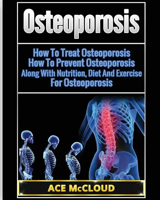 Osteoporosis: How To Treat Osteoporosis: How To Prevent Osteoporosis: Along With Nutrition, Diet And Exercise For Osteoporosis - Paperback