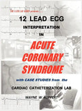 12 Lead ECG Interpretation in Acute Coronary Syndrome with Case Studies from the Cardiac Catheterization Lab - Hardcover