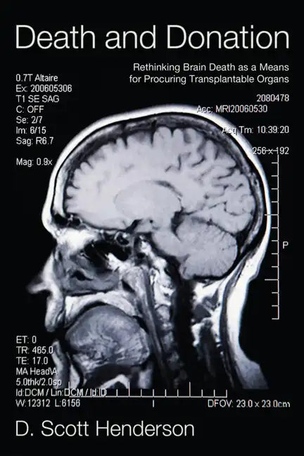Death and Donation: Rethinking Brain Death as a Means for Procuring Transplantable Organs - Hardcover