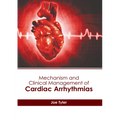 Mechanism and Clinical Management of Cardiac Arrhythmias - Hardcover