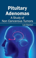 Pituitary Adenomas: A Study of Non Cancerous Tumors - Hardcover