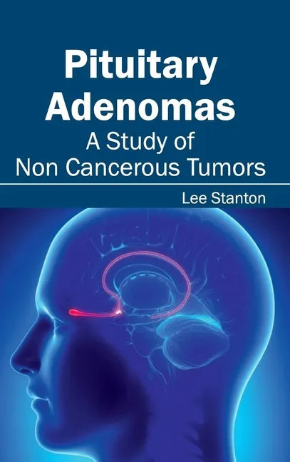 Pituitary Adenomas: A Study of Non Cancerous Tumors - Hardcover
