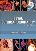 Fetal Echocardiography - Simplified - Paperback