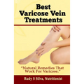 Best Varicose Vein Treatments: Natural Remedies That Work for Varicose - Paperback