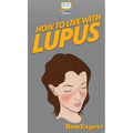 How To Live With Lupus: Your Step By Step Guide To Living With Lupus - Hardcover