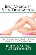 Best Varicose Vein Treatments: Natural Remedies That Work For Varicose - Paperback
