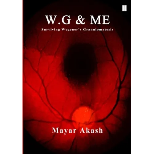 W.G & ME, Surviving Wegener's Granulomatosis: Wegener's Granulomatosis - Paperback