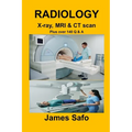 RADIOLOGY X-ray, MRI & CT scan: Plus over 140 Q & A - Paperback