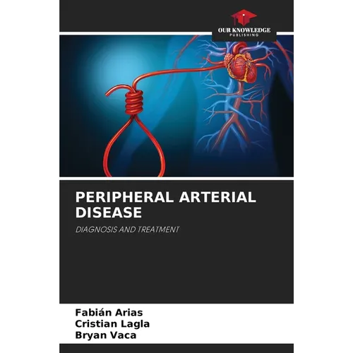 Peripheral Arterial Disease - Paperback