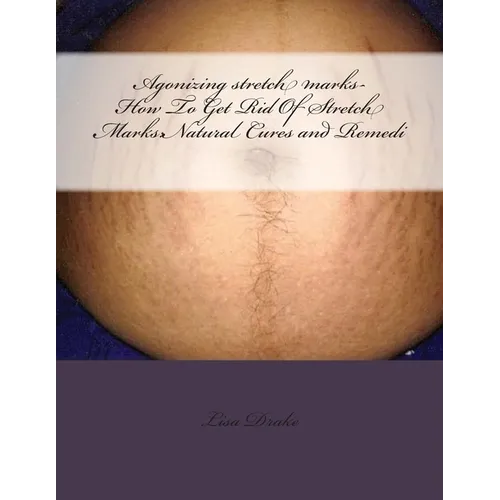 Agonizing stretch marks-How To Get Rid Of Stretch Marks: Natural Cures and Remedi - Paperback